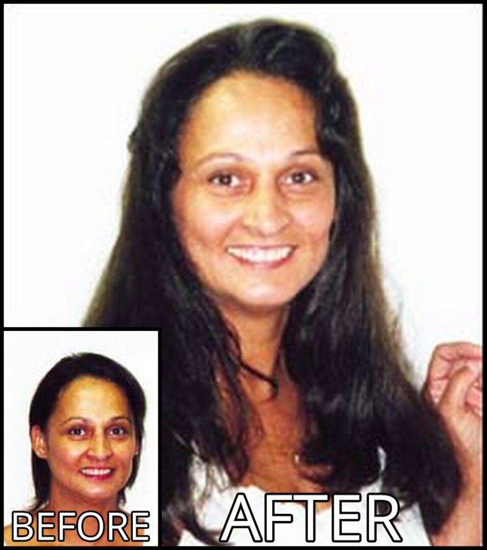 Side-by-side comparisons of a woman's face labeled "Before" and "After." The "After" image shows her smiling with an apparent hairstyle change.